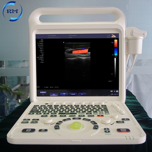 color ultrasound machine 03