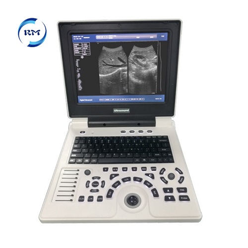 BW ultrasound machine