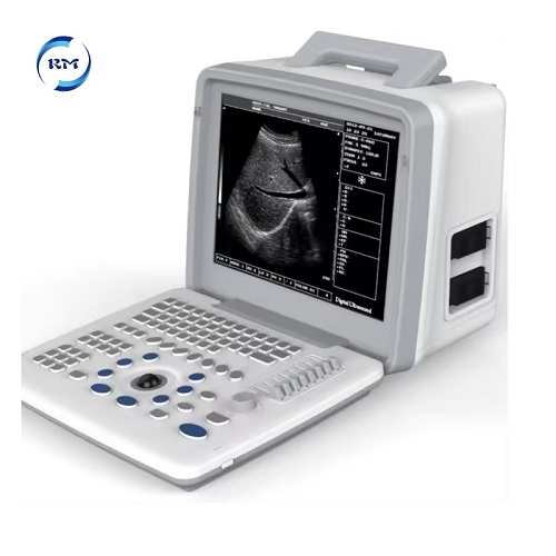 BW ultrasound machine 04