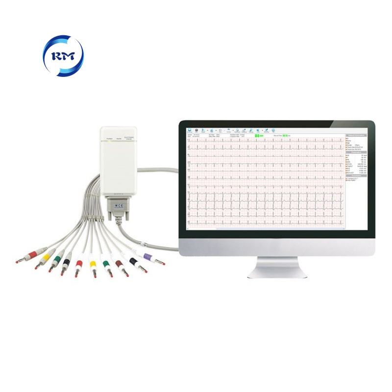 ecg workstation